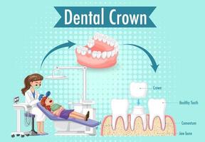 infográfico de humano na coroa dentária vetor