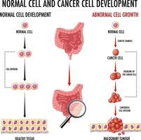 diagrama mostrando células normais e cancerosas vetor