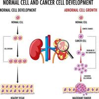 diagrama mostrando células normais e cancerosas vetor