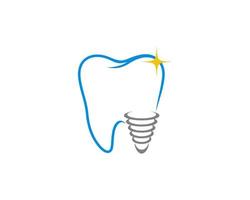 dentes limpos com logotipo de implante vetor