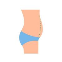 barriga saliente da mulher, correção grande barriga gorda, abdominoplastia. excesso de peso. perda de peso, redução do volume do corpo, cirurgia plástica. ilustração vetorial de vista lateral vetor