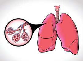 o diagrama ilustra a traqueia saudável e os sacos aéreos dos pulmões humanos destacados com linhas pretas para facilitar a visualização.