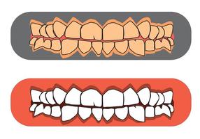 Vetores livres de dentes e gomas