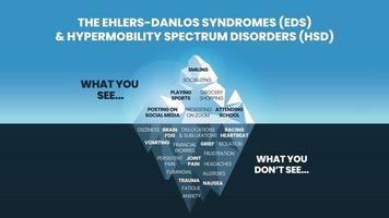 o modelo de iceberg das síndromes de ehlers-danlos eds e transtorno do espectro de hipermobilidade hds conceito tem o sintoma de superfície pode ver comportamento feliz e normal para análise e diagnóstico psicológico vetor