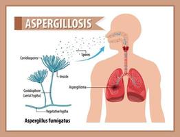 diagrama mostrando a infecção por aspergillus vetor