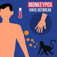 ilustração de surto de vírus monkeypox adequada para pôster e infográfico vetor