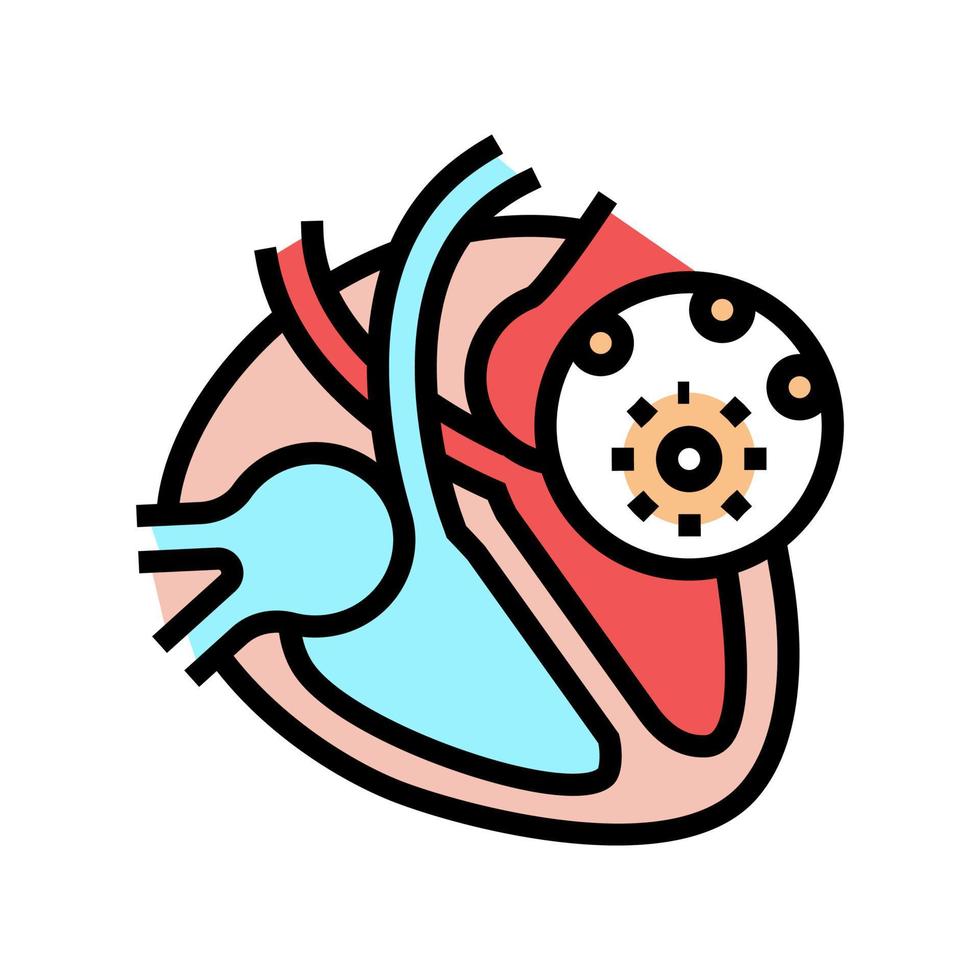 illustrazione vettoriale dell'icona del colore della malattia della miocardite