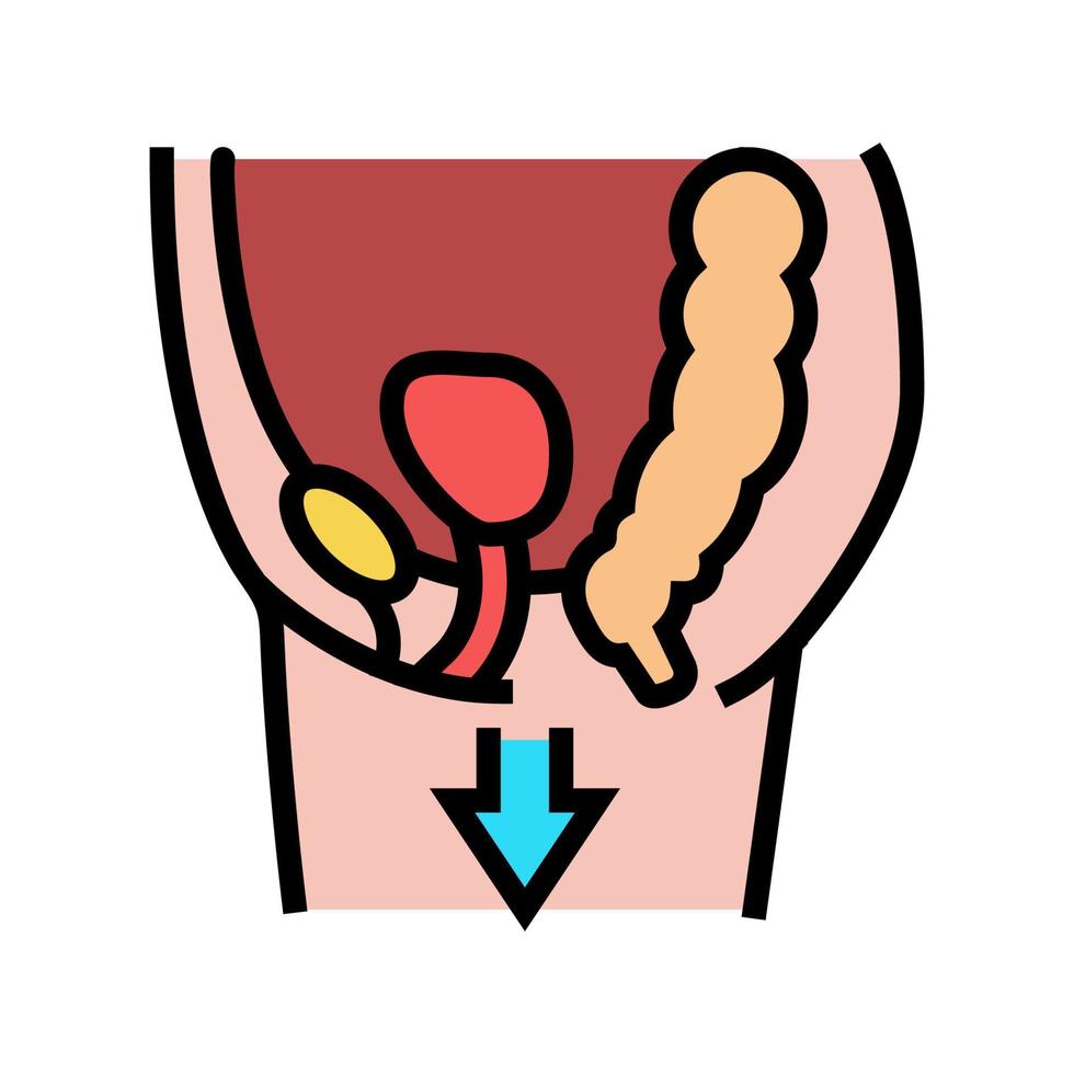 illustrazione vettoriale dell'icona del colore della malattia del prolasso d'organo