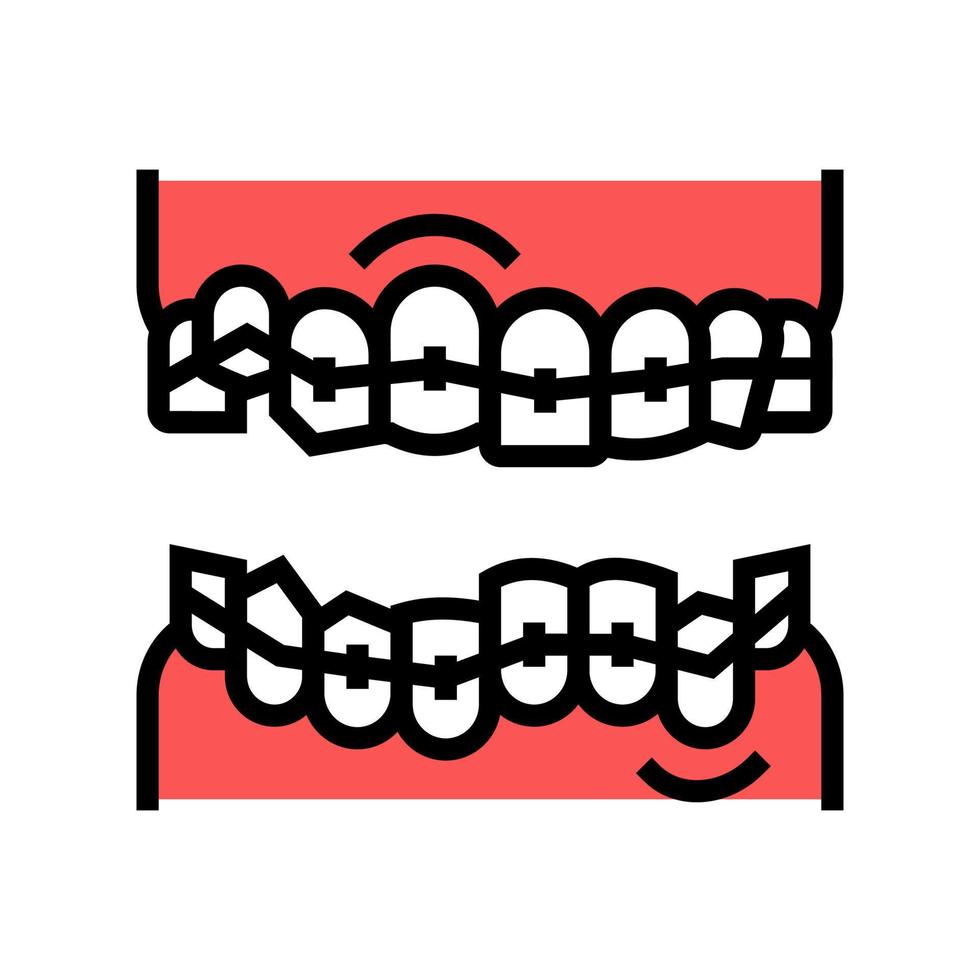 illustrazione vettoriale dell'icona del colore delle parentesi graffe dei denti di correzione