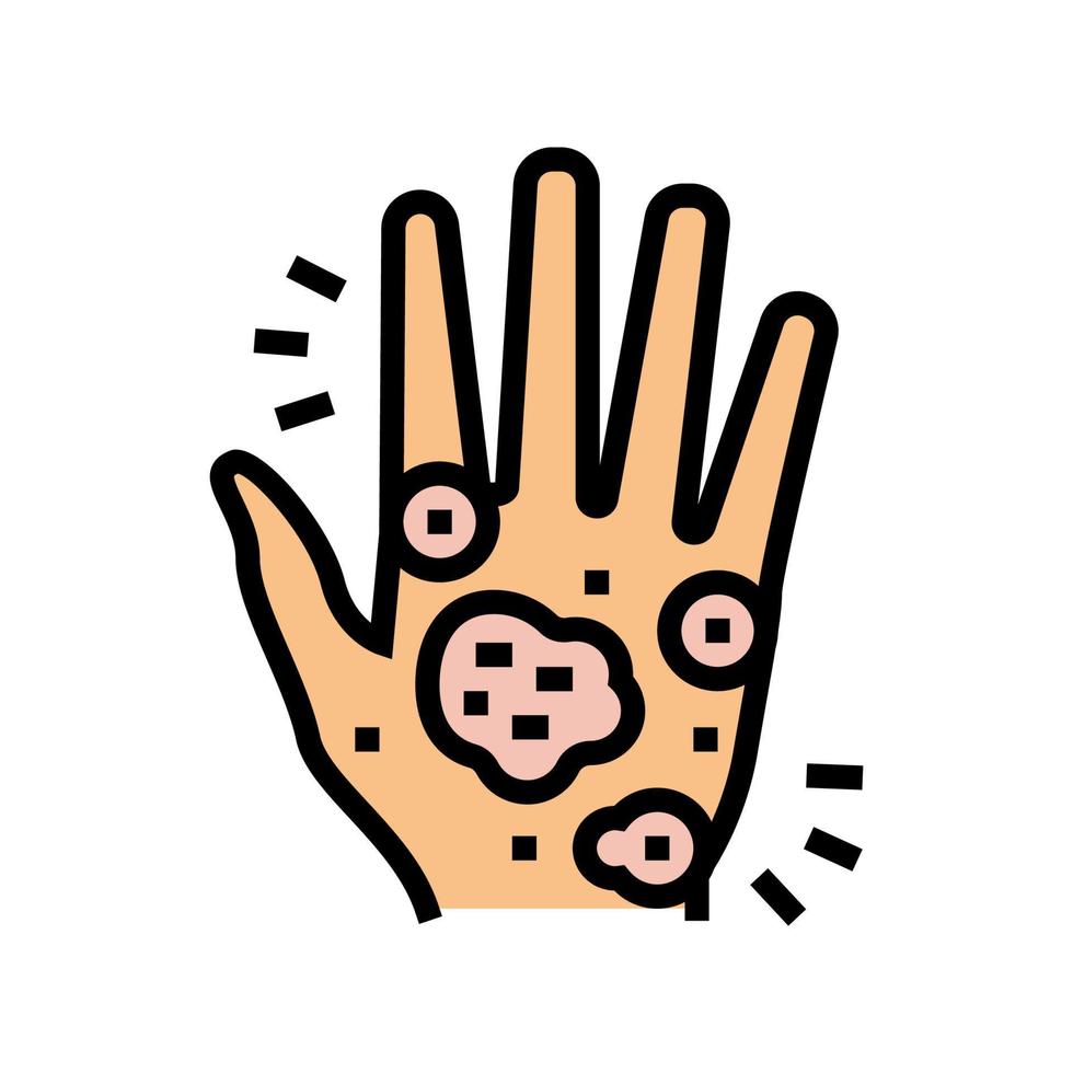 illustrazione vettoriale dell'icona del colore dell'eczema della mano