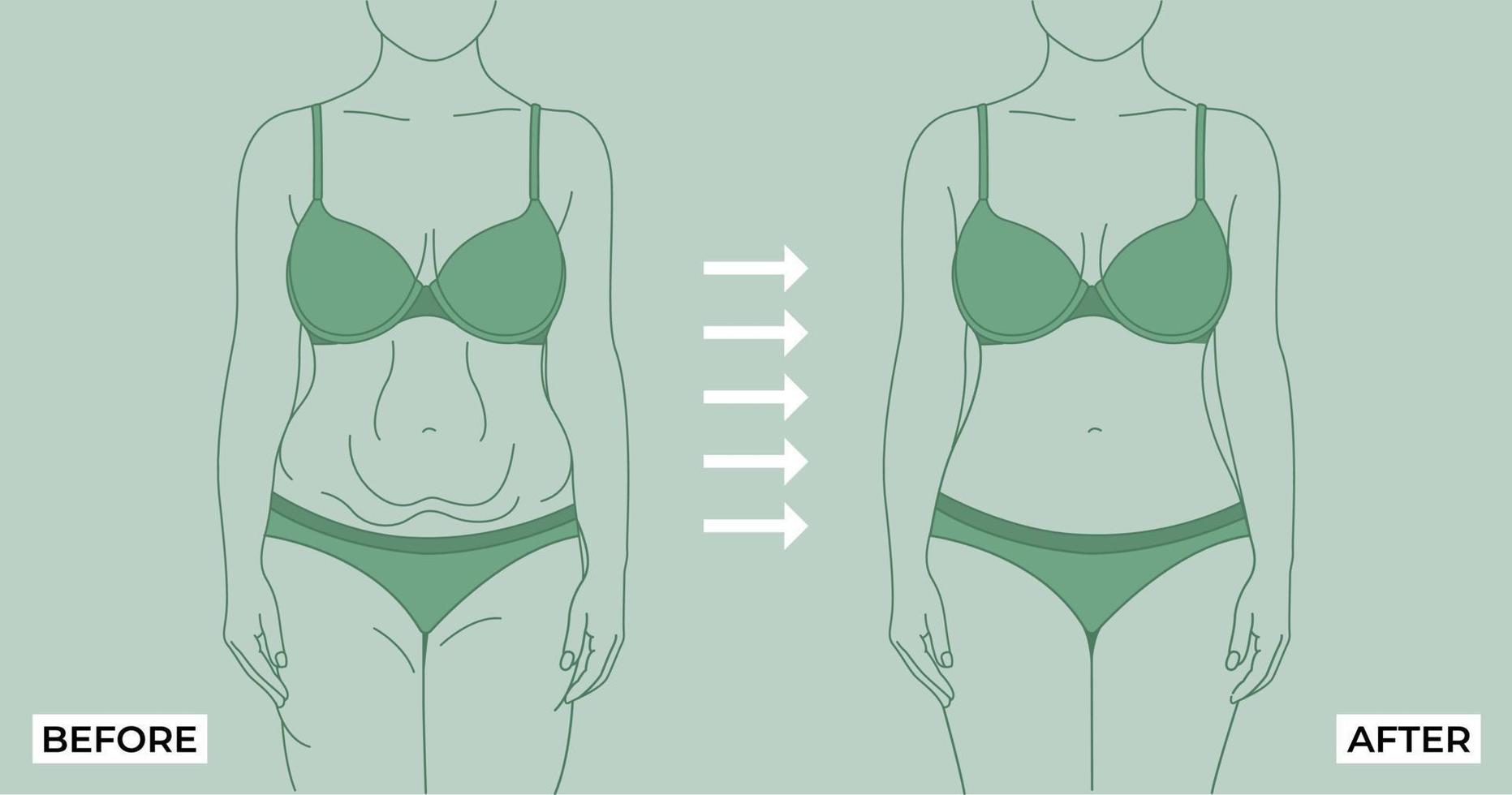 Grasso per in forma. prima e dopo peso perdita Grasso e sottile donna su un' leggero sfondo vettore illustrazione. Grasso e magro femmina corpo.