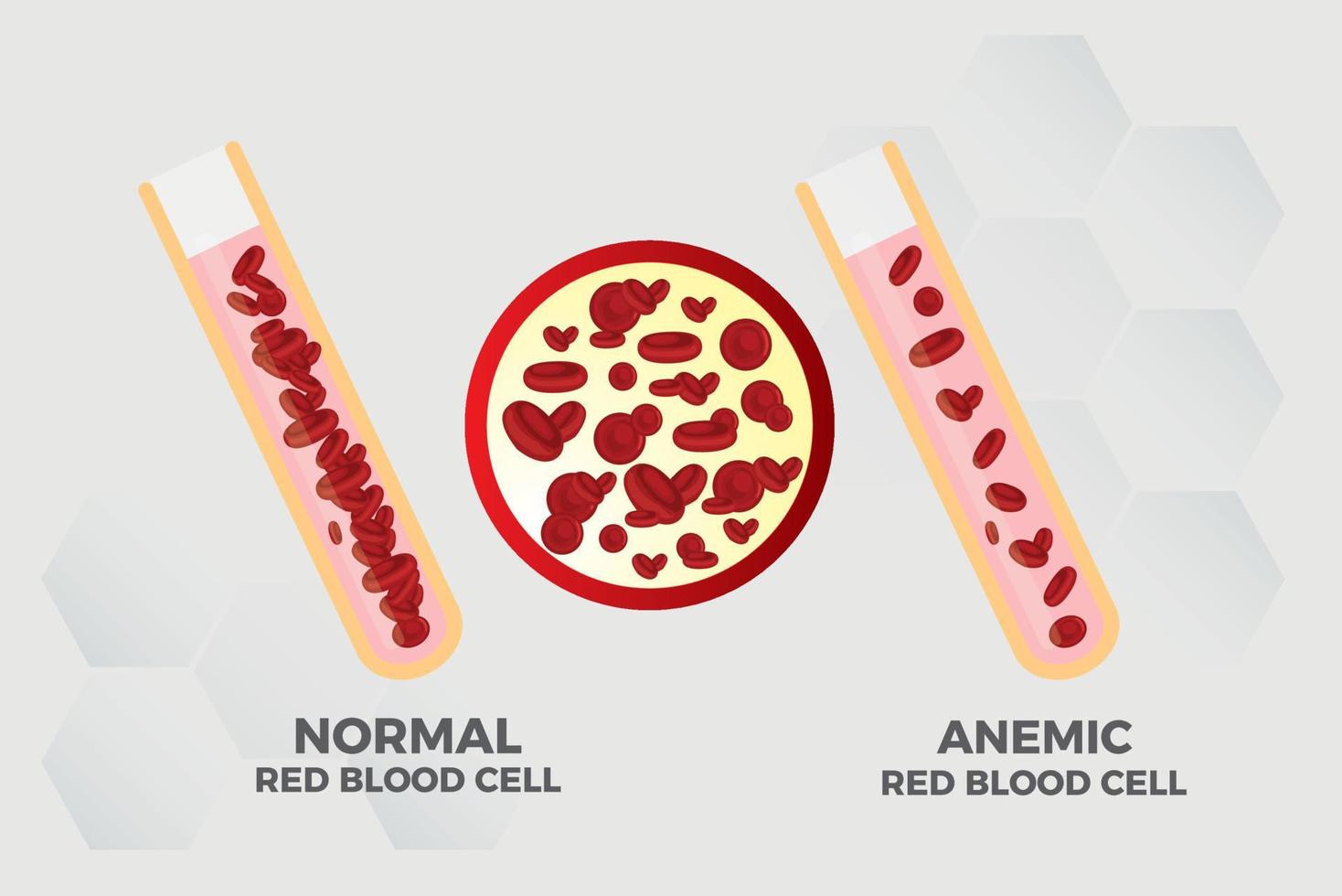 anemia ferro rosso sangue cellula medico vettore illustrazione medico.