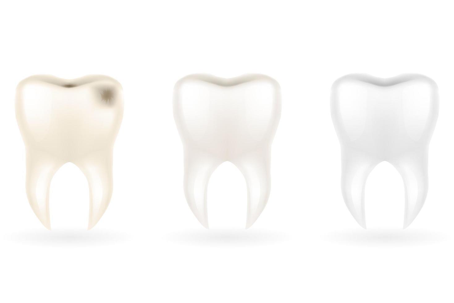 umano radice dente modello vettore illustrazione isolato su bianca sfondo
