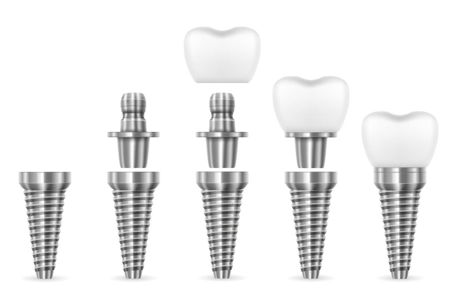 metallo umano dente impiantare vettore illustrazione isolato su bianca sfondo