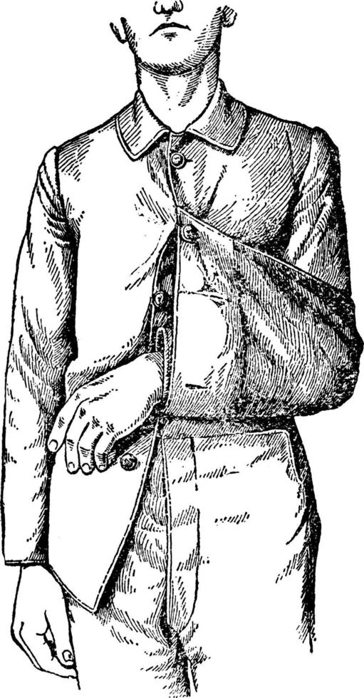 cappotto fionda, Vintage ▾ illustrazione vettore