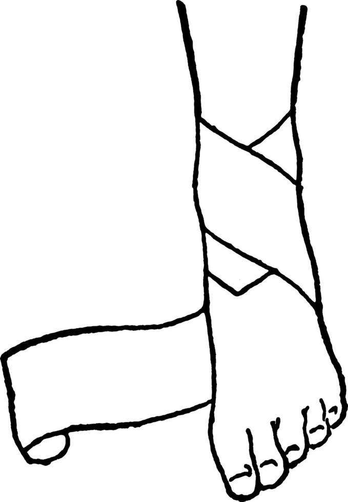 bendato gamba, Vintage ▾ illustrazione. vettore