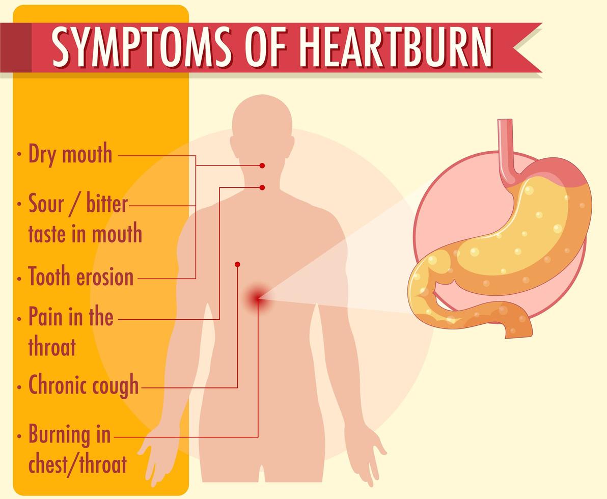 sintomi di infografica di informazioni di bruciore di stomaco vettore