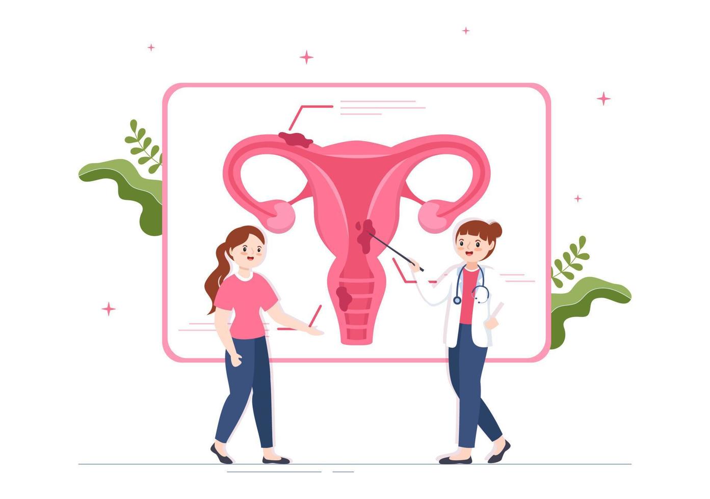 endometriosi con condizione il endometrio cresce al di fuori il uterino parete nel donne per trattamento nel piatto cartone animato mano disegnato modelli illustrazione vettore