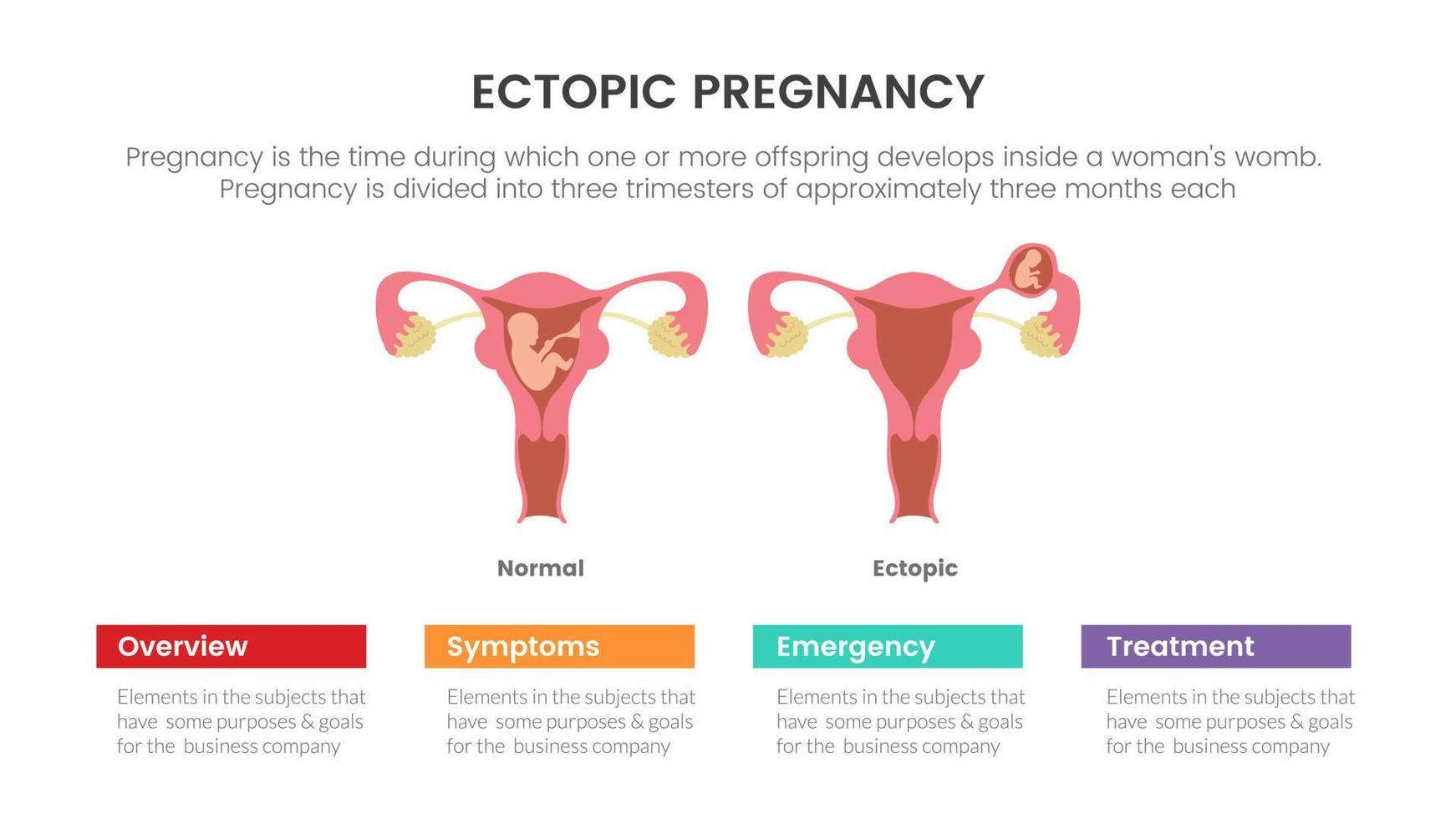 ectopico incinta o gravidanza Infografica concetto per diapositiva presentazione con 3 punto elenco vettore