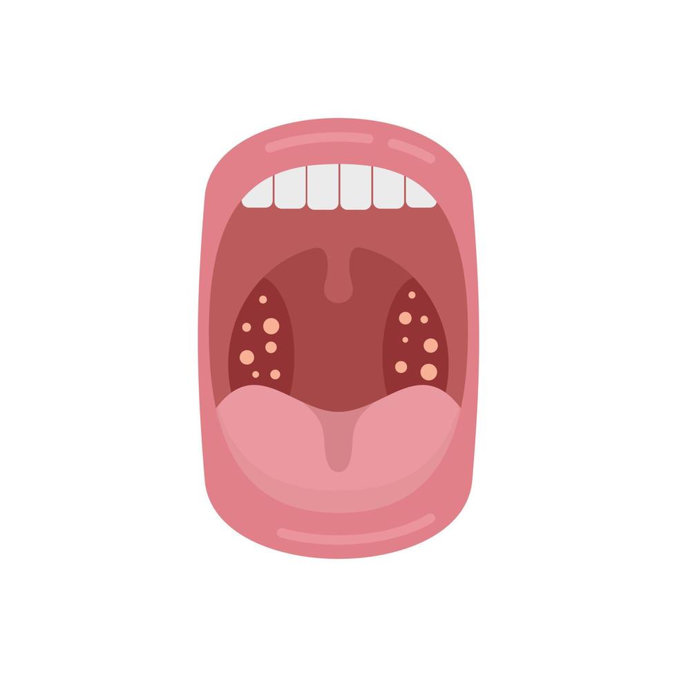 bocca malattia icona piatto vettore. batterico anatomia vettore