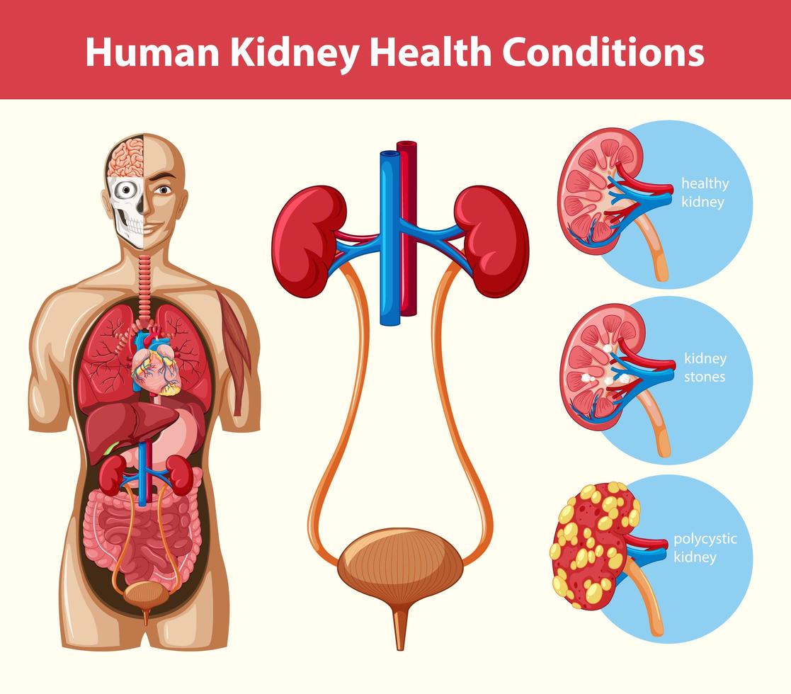 infografica sulle condizioni di salute del rene umano vettore
