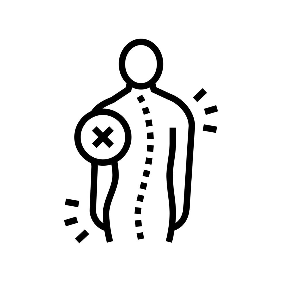 idiopatica scoliosi linea icona vettore illustrazione