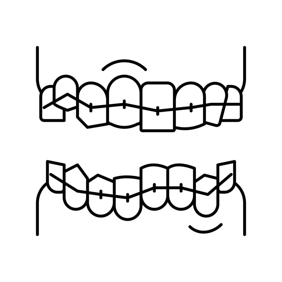 illustrazione vettoriale dell'icona della linea delle parentesi graffe dei denti di correzione