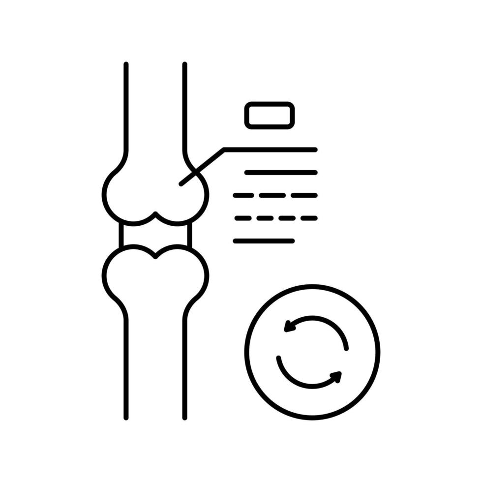 illustrazione vettoriale dell'icona della linea di trapianto della cartilagine del ginocchio