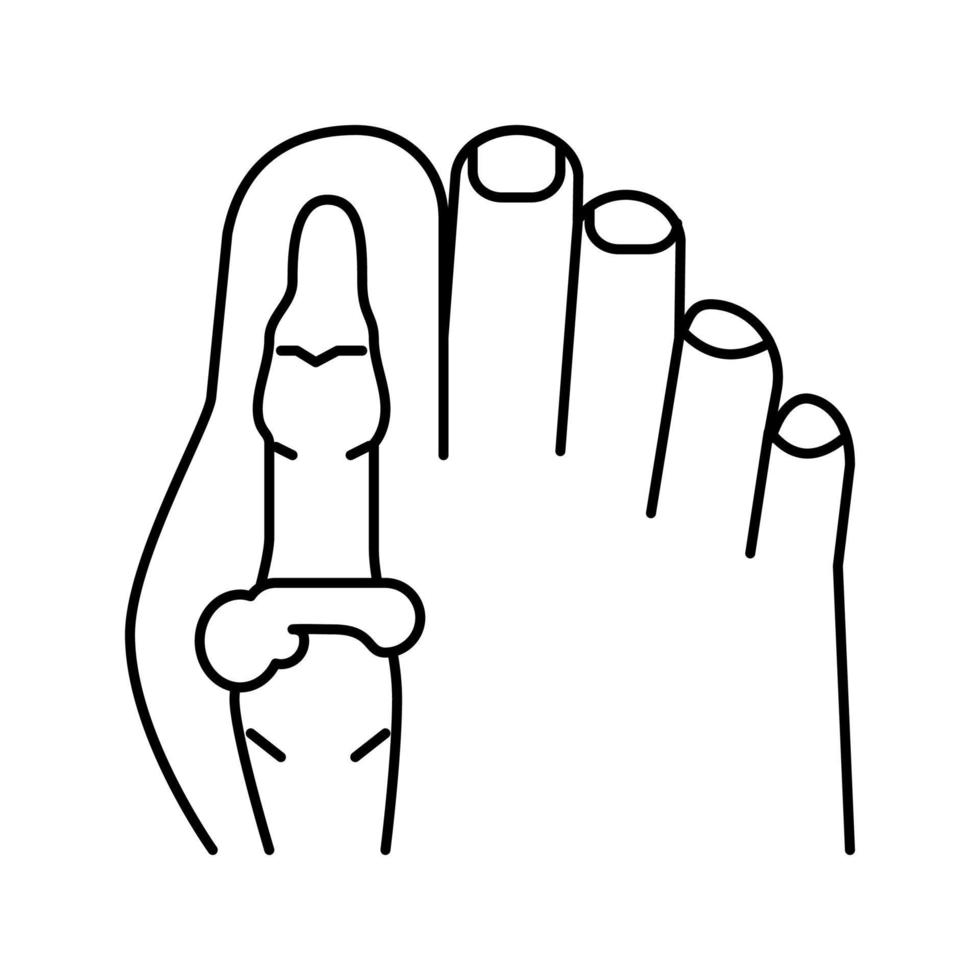 piede grande dito del piede osso gotta linea icona vettore illustrazione