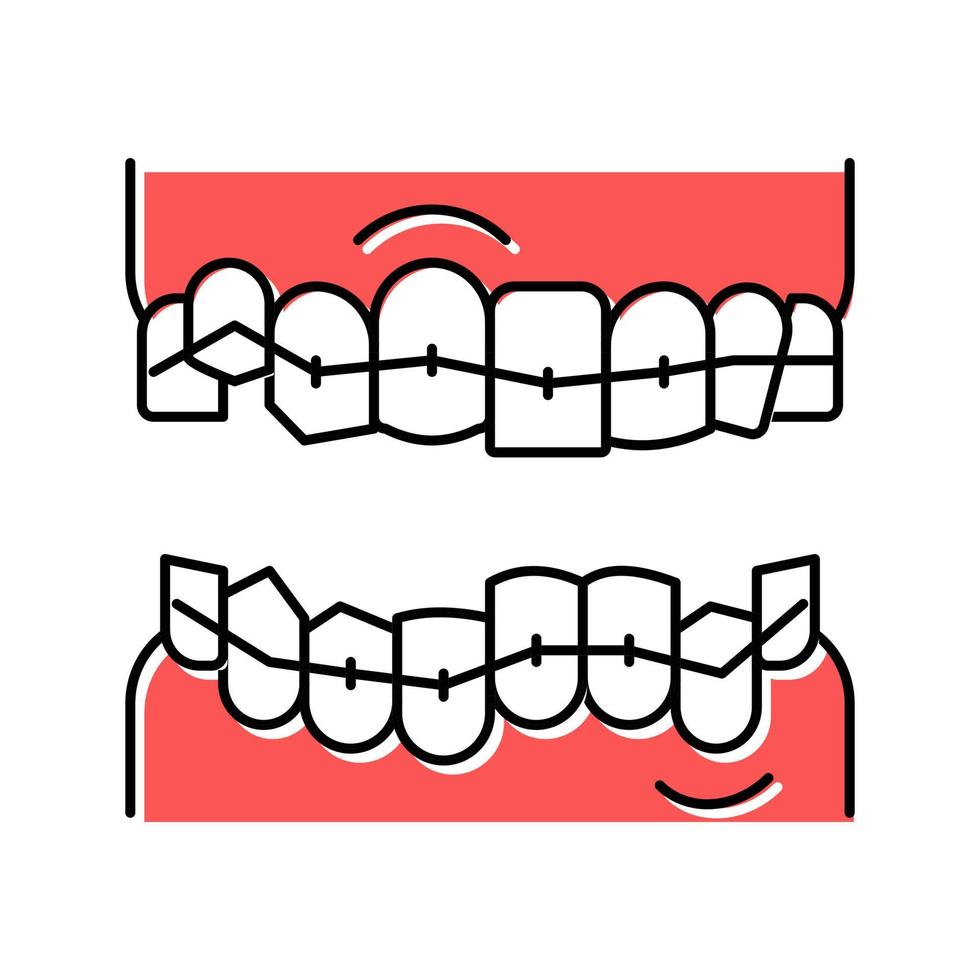 illustrazione vettoriale dell'icona del colore delle parentesi graffe dei denti di correzione