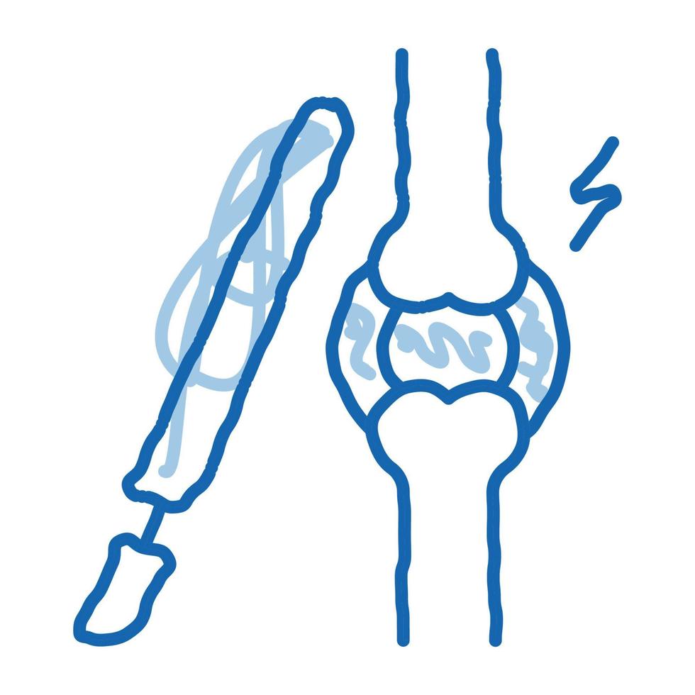 artroscopia dai un'occhiata scarabocchio icona mano disegnato illustrazione vettore
