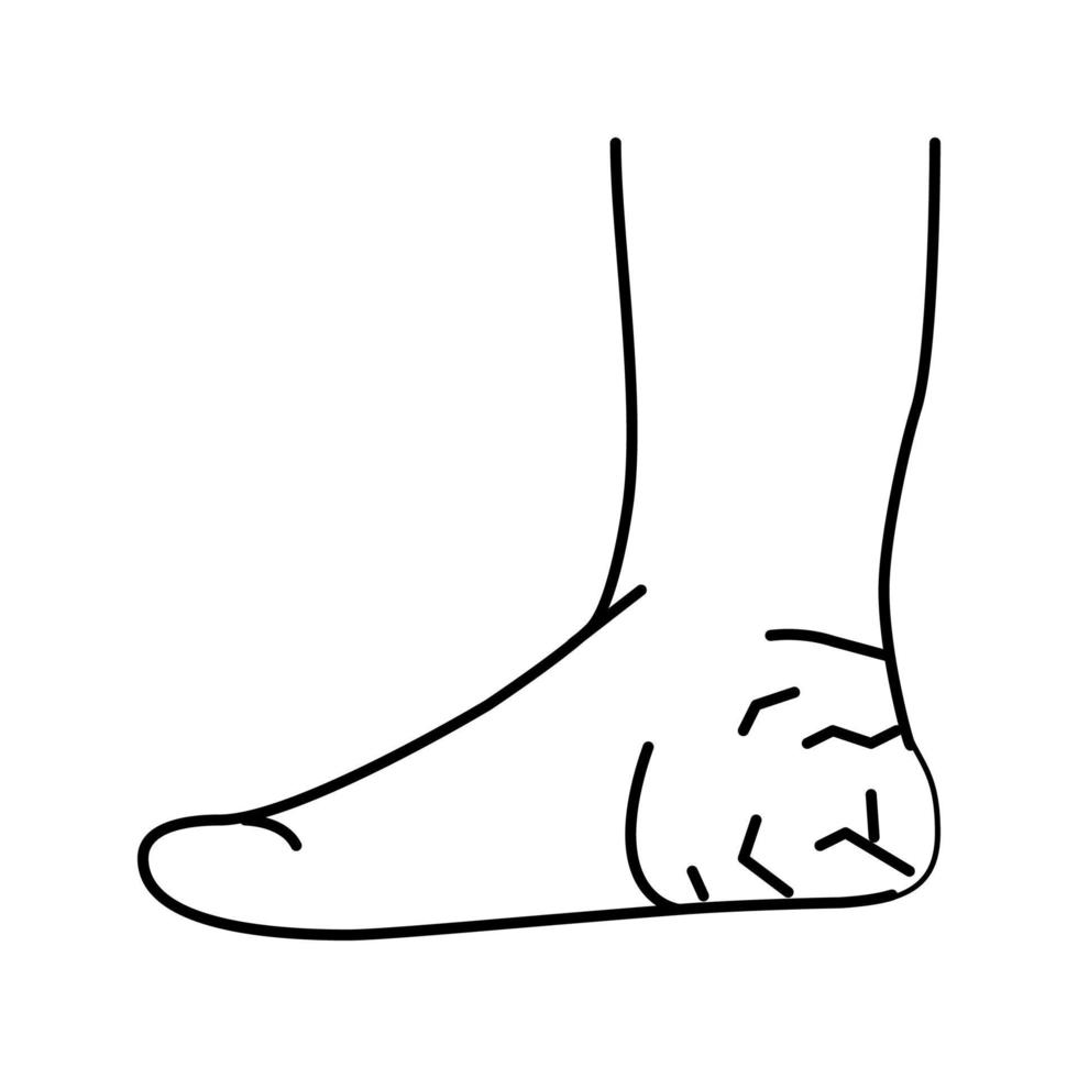 illustrazione vettoriale dell'icona della linea della pelle secca dei talloni