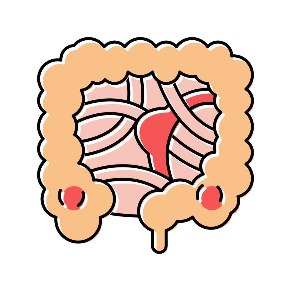 illustrazione vettoriale dell'icona del colore della malattia dell'ostruzione intestinale