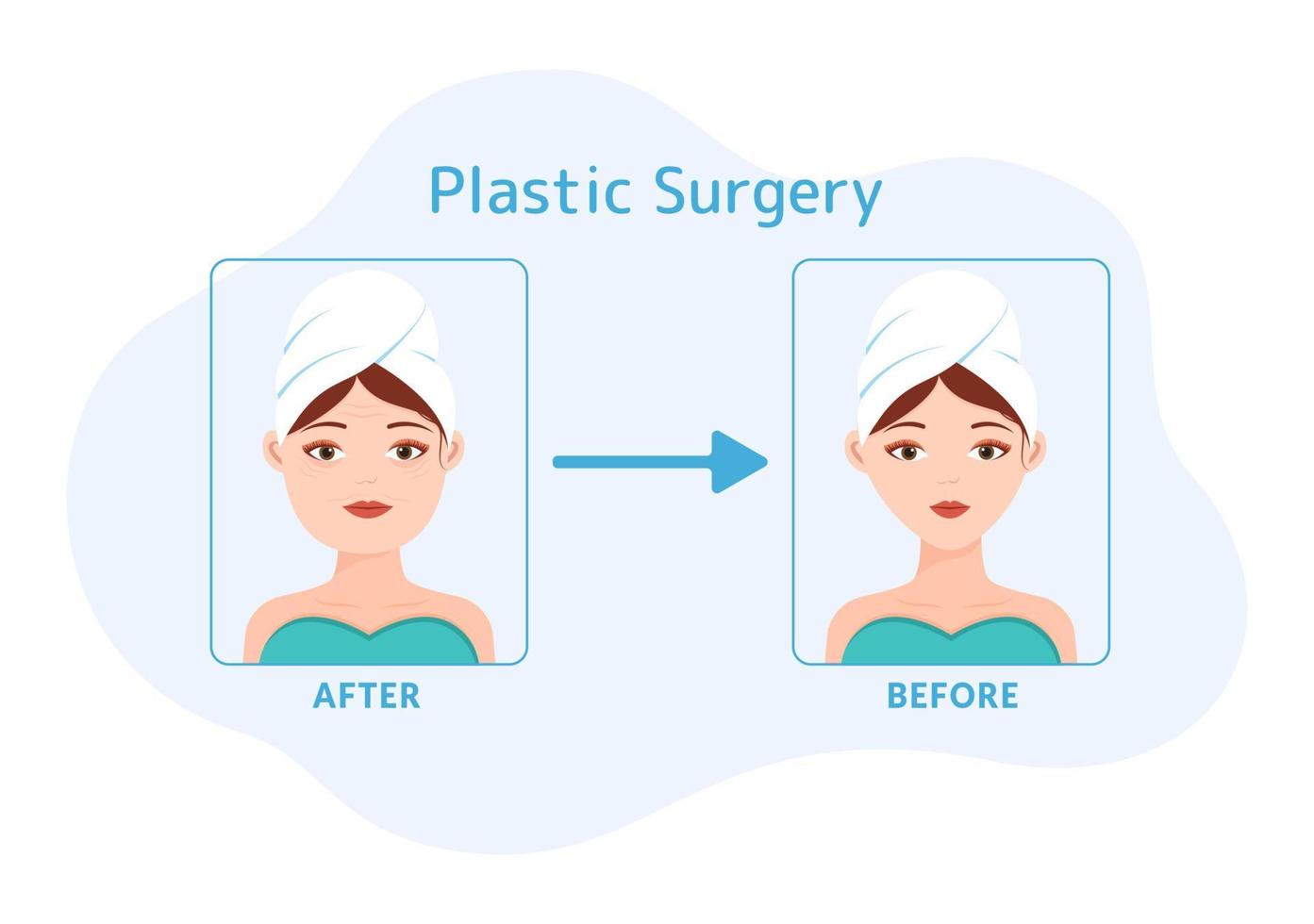 plastica chirurgia piatto cartone animato mano disegnato modelli illustrazione di medico chirurgico operazione su il corpo o viso come previsto utilizzando Avanzate attrezzatura vettore
