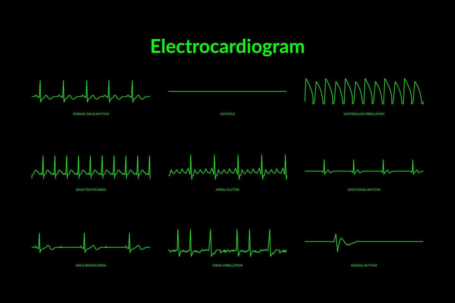 elettrocardiogramma battito cardiaco linea tenere sotto controllo. vettore eps10 illustrazione