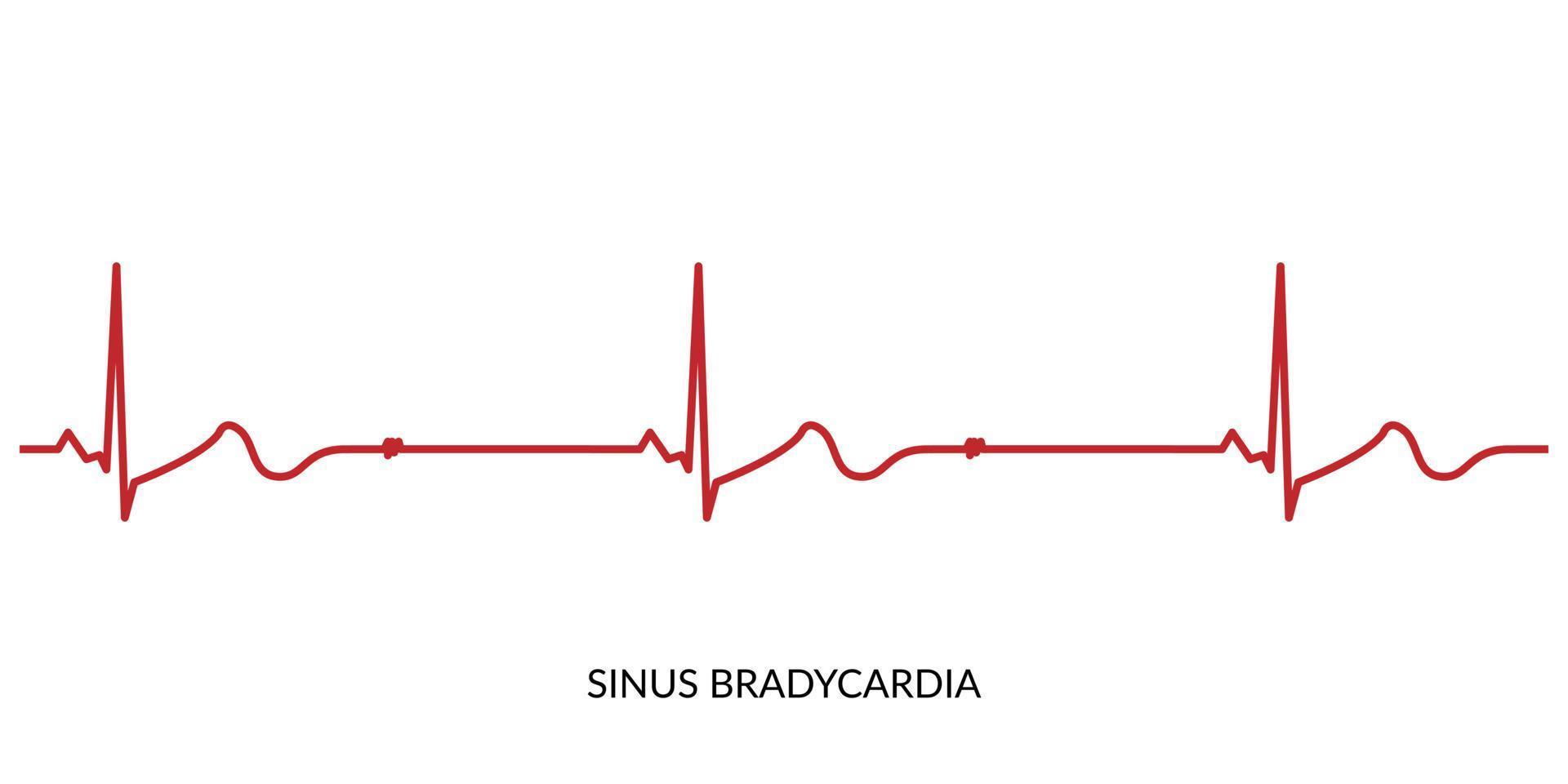 ecg battito cardiaco linea. elettrocardiogramma vettore illustrazione. seno bradicardia