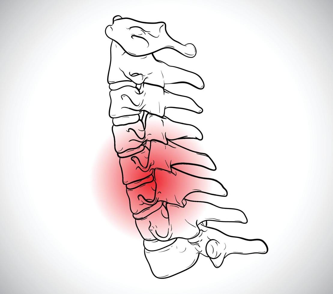 vertebre clinicamente corrette del rachide cervicale vettore