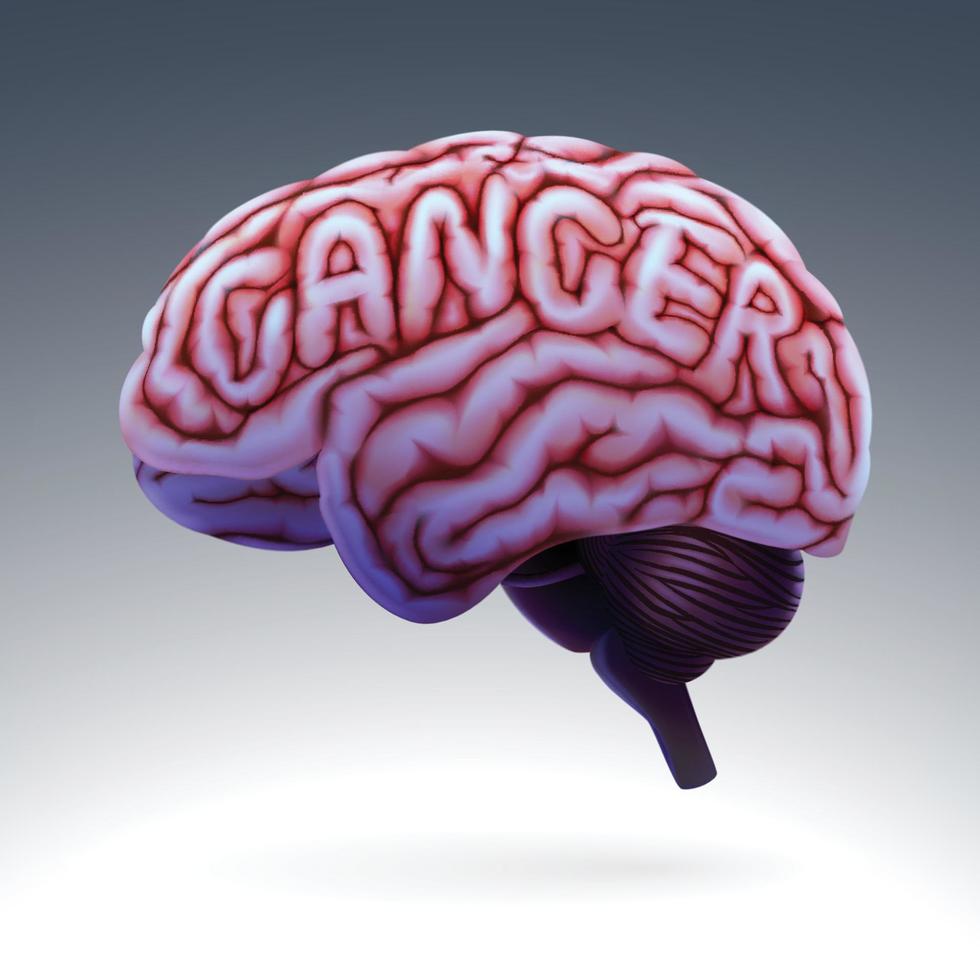 3d umano cervello illustrazione arricciato in parola cancro. vettore
