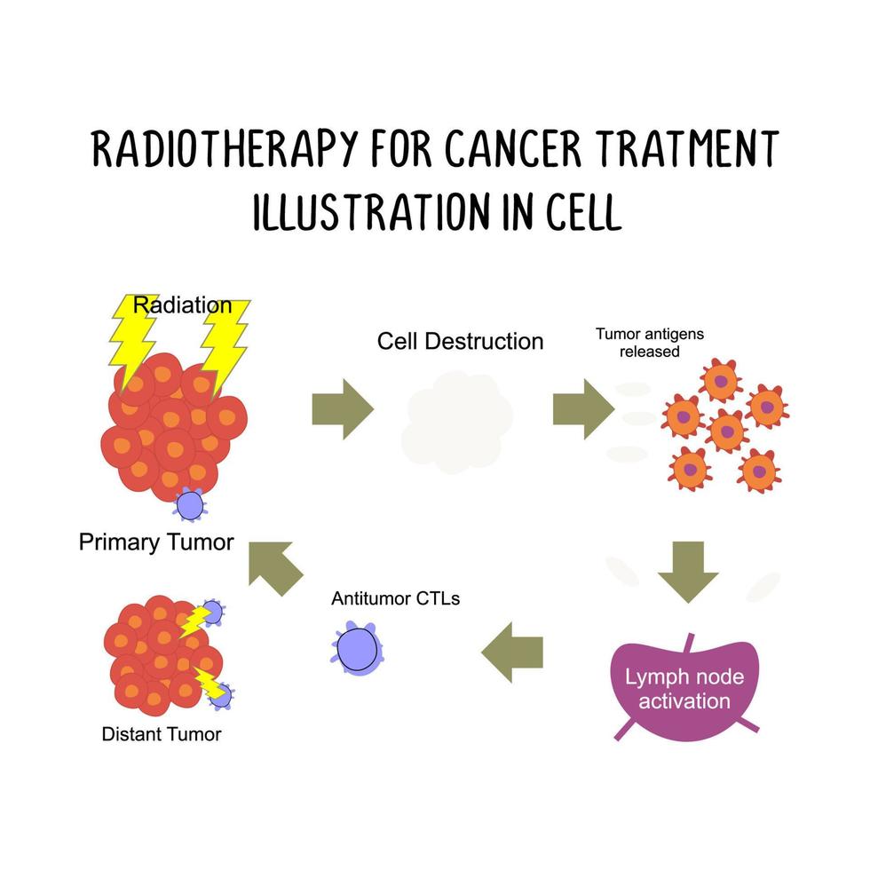 radioterapia per cancro trattamento illustrazione nel cellula vettore
