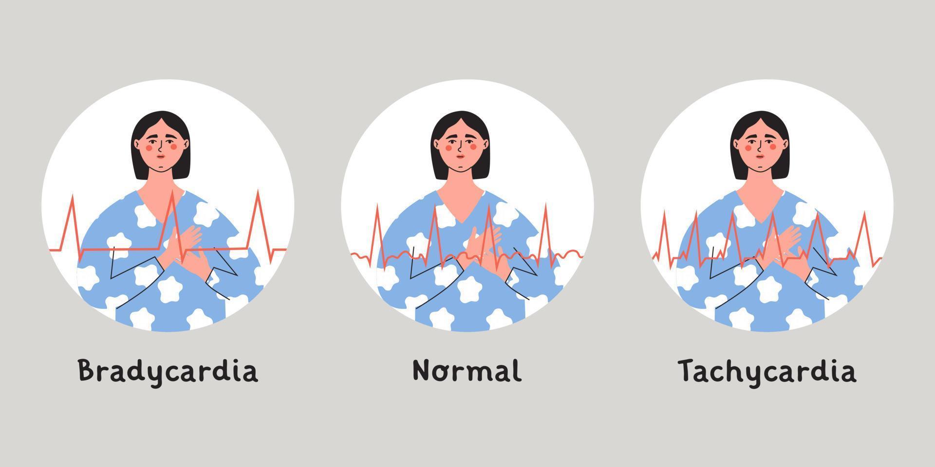tipi di cuore aritmia. bradicardia, tachicardia e horalhertbeat ritmo. donna stampa sua il petto con mano. vettore