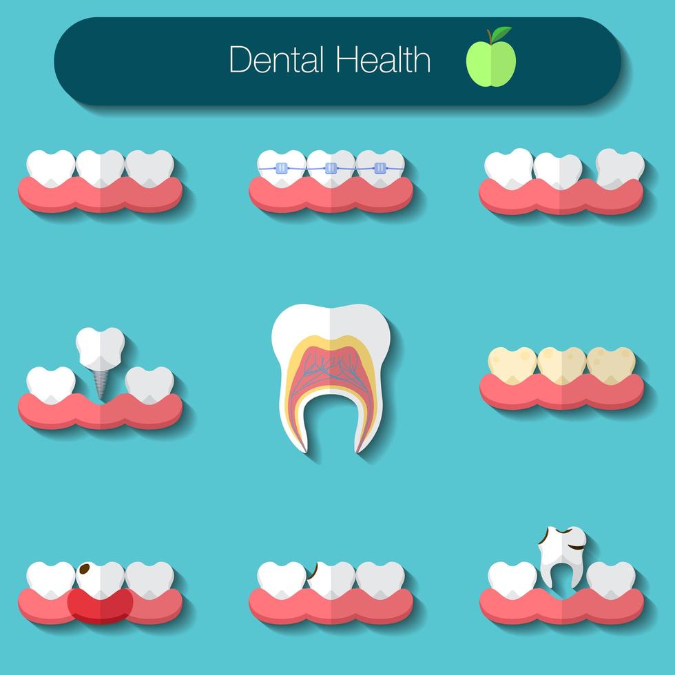 cure odontoiatriche design piatto illustrazione vettoriale di heathy denti, carie, sistema di bretelle, impianto e altre icone di salute dentale impostate