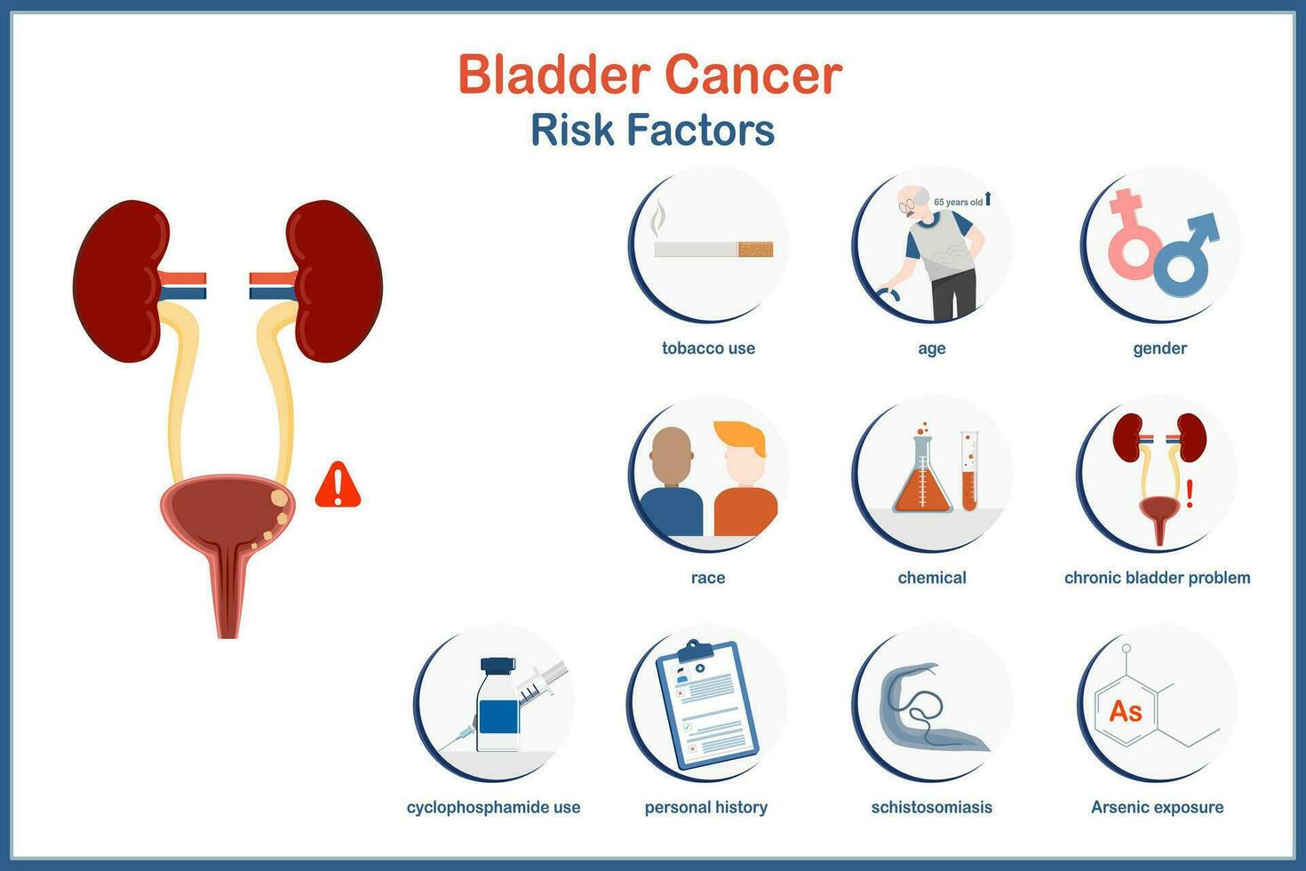 medico vettore illustrazione nel piatto stile. Infografica Vescica urinaria cancro rischio fattori come come tabacco utenti, arsenico esposizione, cronico cistite, ciclofosfamide utenti ,sesso,età,personale storia eccetera.