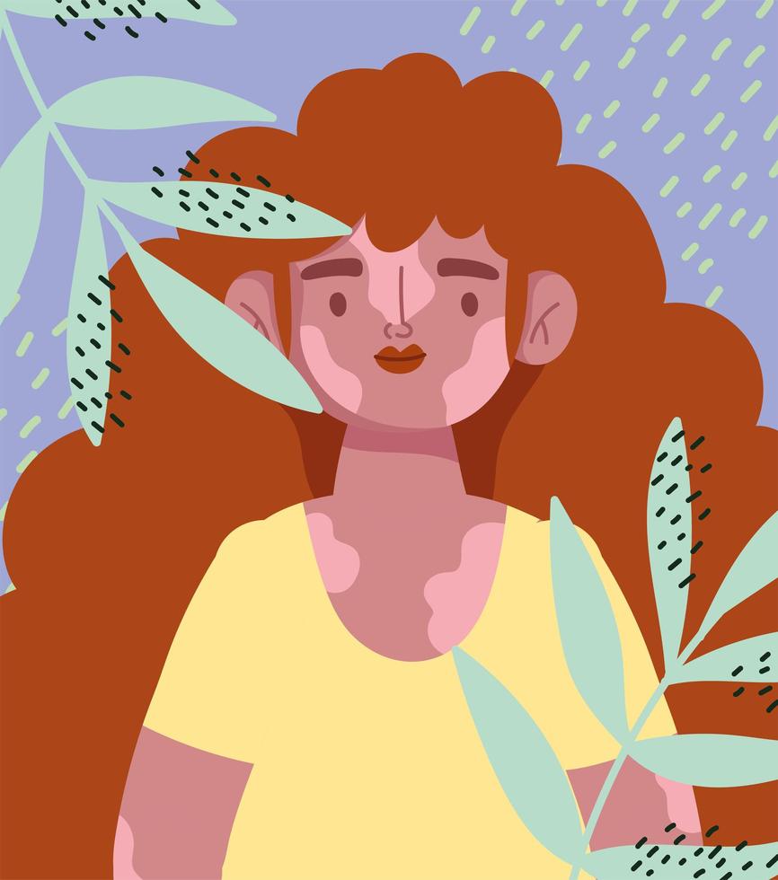 perfettamente imperfetto, cartone animato ragazza capelli ricci e vitiligine, carta decorazione foglie vettore