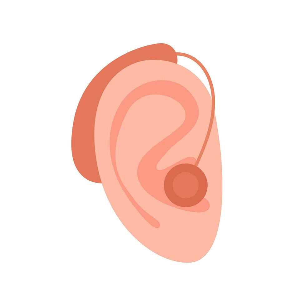 orecchio udito aiuto dispositivo, Aiuto per alterata di udito. sordità, udito perdita. sordo con sentire problema. udito restauro attraverso Audio tubo. vettore illustrazione