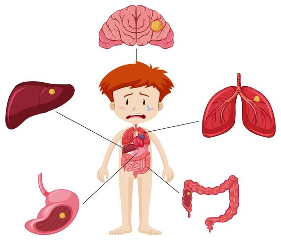 Ragazzo e diagramma che mostrano le diverse parti degli organi con la malattia vettore