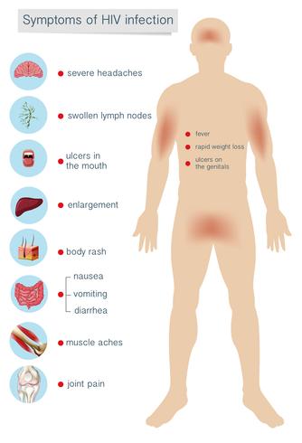 Sintomi di Anatomia umana dell&#39;infezione da HIV vettore