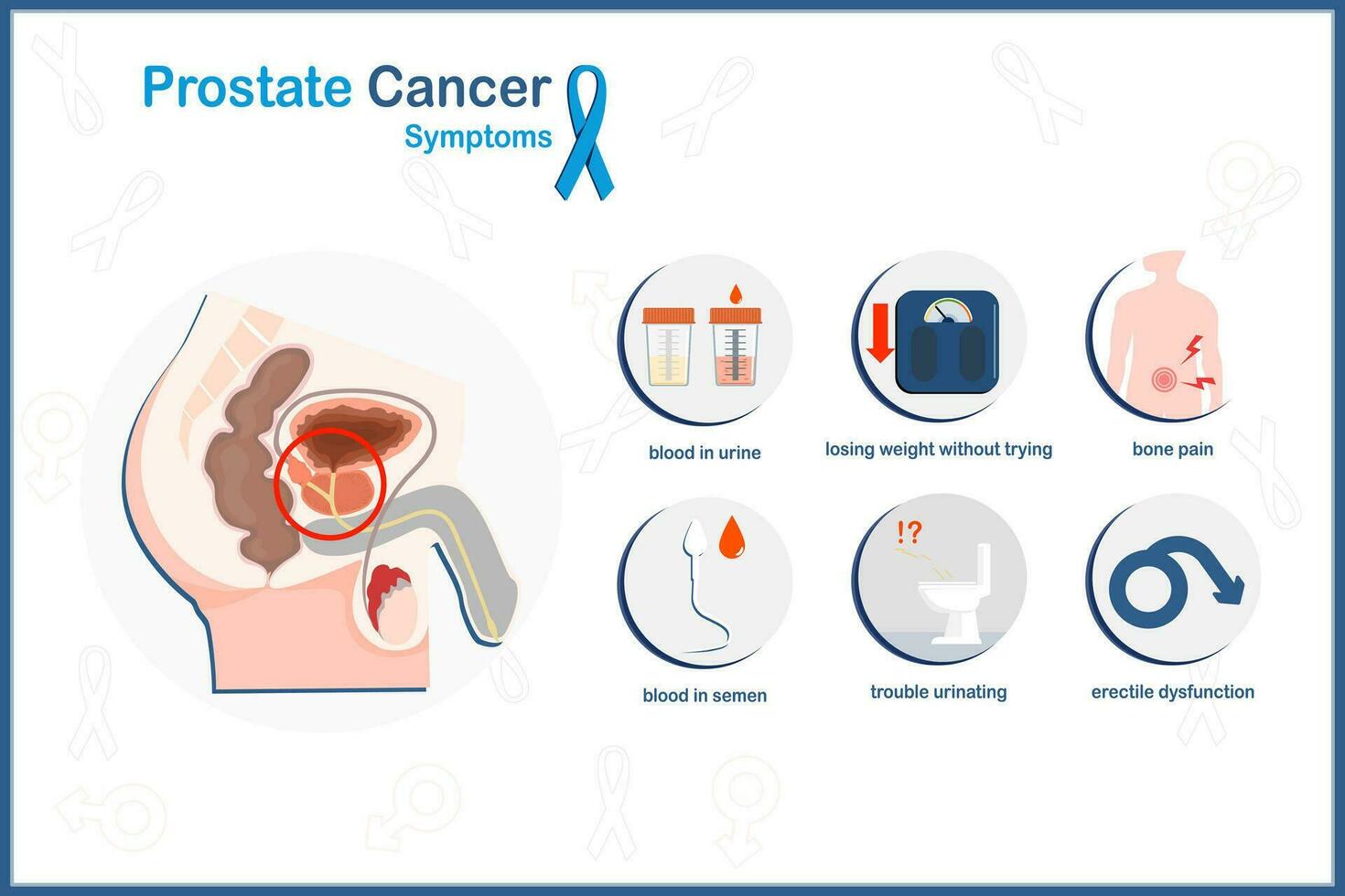 vettore medico illustrazione nel piatto stile, prostata cancro concetto.prostata cancro sintomi.problemi urinare, ossa dolore, peso perdita, sangue nel urina e sperma, erettile disfunzione.piatto stile.