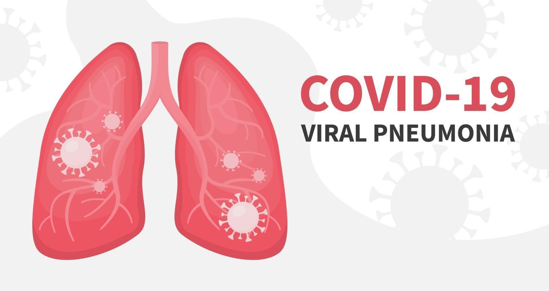polmoni umani e polmonite virale covid coronavirus vettore