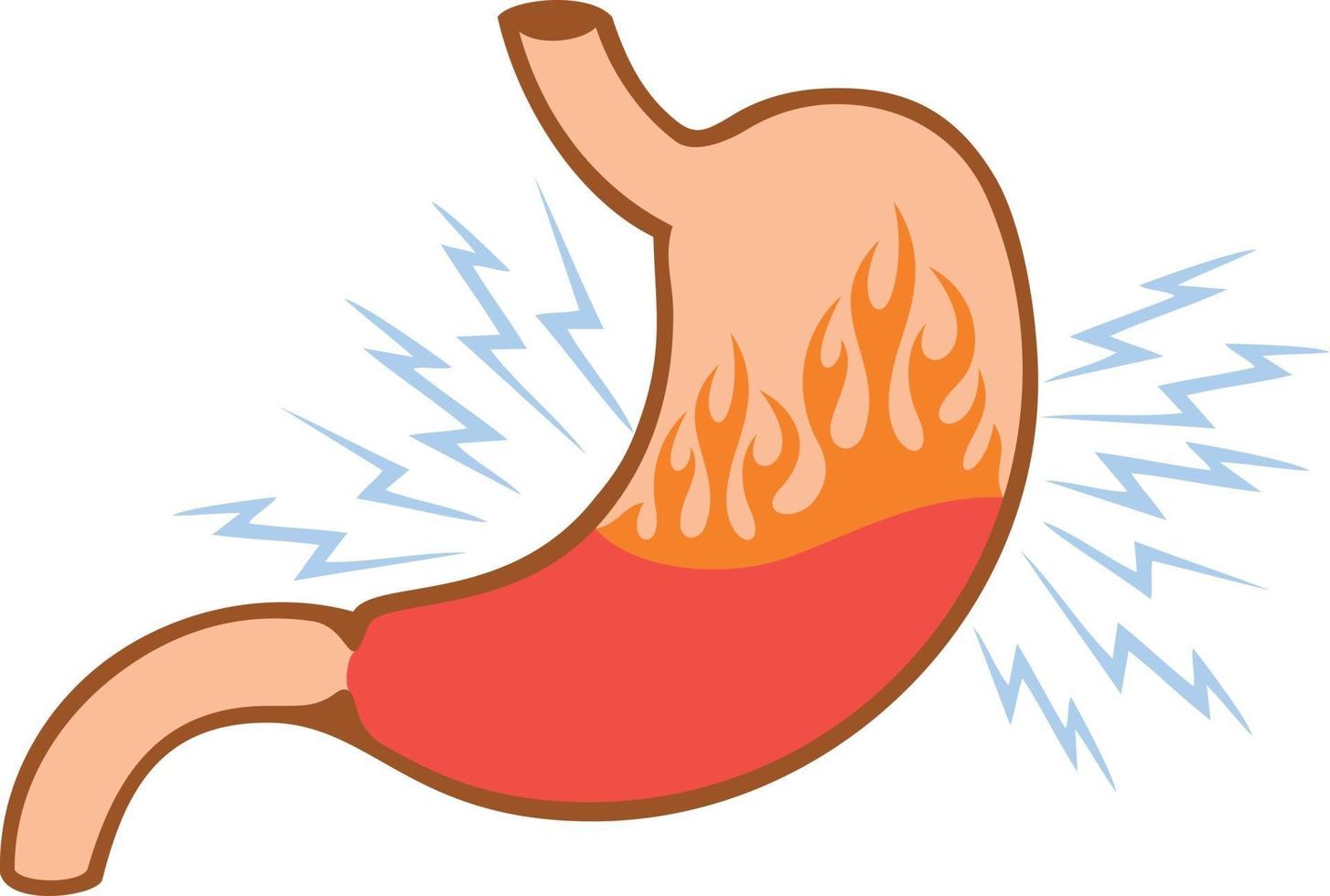 problema di bruciore di stomaco nello stomaco interno umano vettore