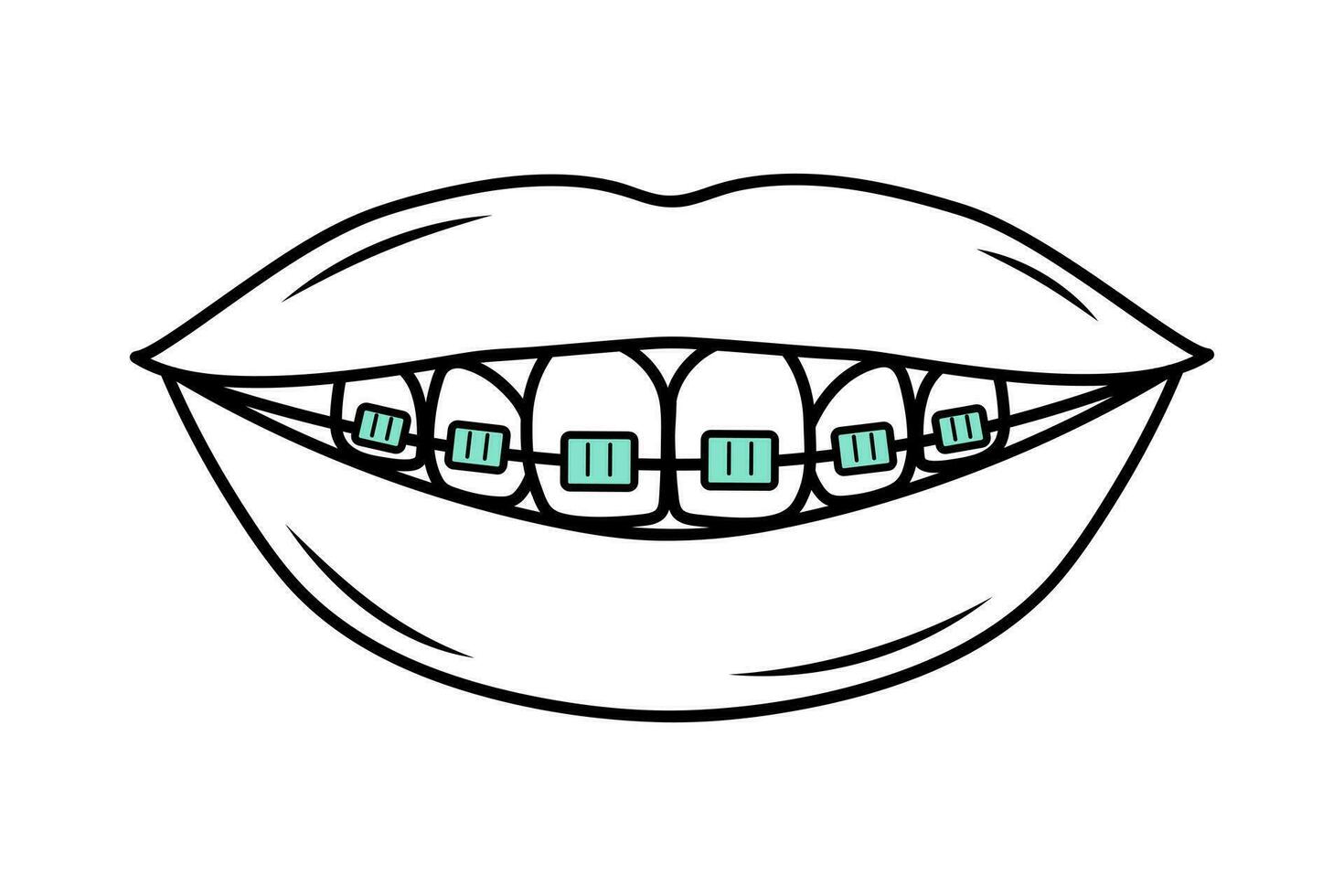 umano bocca con denti nel bretelle nel scarabocchio stile. correttiva ortodonzia. dentale cura. lineare vettore illustrazione.